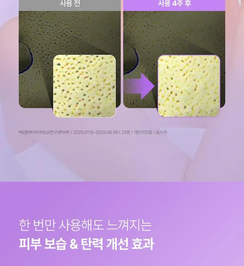 [1등마스크|콜라겐&탄력] 바이오힐 보 프로바이오덤 마스크팩 3종 기획 상세페이지 79